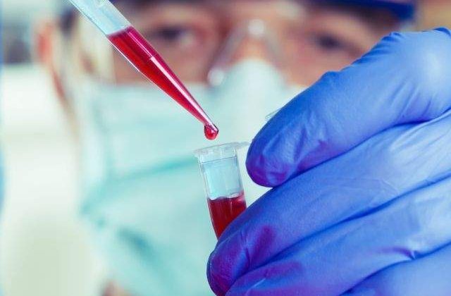 Brazilia a inceput sa vanda teste HIV in farmacii