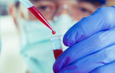 Brazilia a inceput sa vanda teste HIV in farmacii