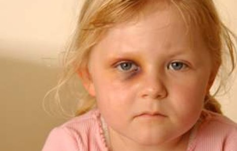 Copiii, victimele noastre tacute
