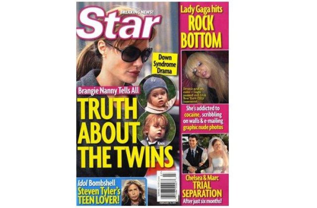 Gemenii Angelinei Jolie sufera de sindromul Down?