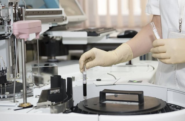 Topul investigatiilor prin care oncologii romani depisteaza un cancer incipient