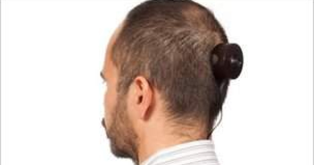 Artistul care si-a implantat o camera foto in cap, nevoit sa o scoata