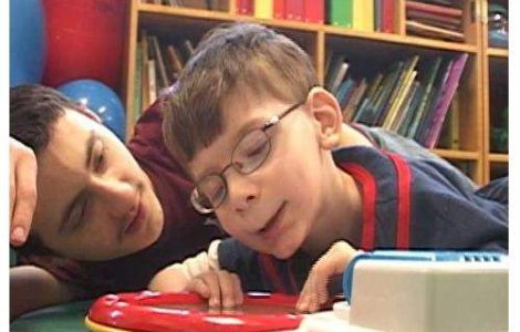  Video  Uimitor: Nu are cerebel si traieste!