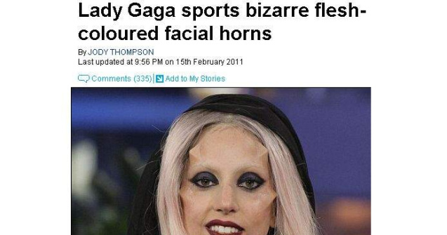  Video  Lady Gaga si-a implantat "coarne" sub piele?