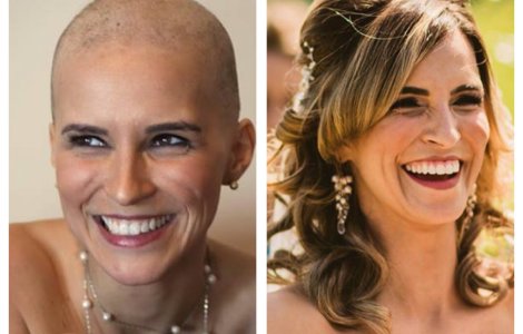  Top  10 imagini cu persoane care au invins cancerul. Te vor face sa apreciezi cu adevarat fiecare zi