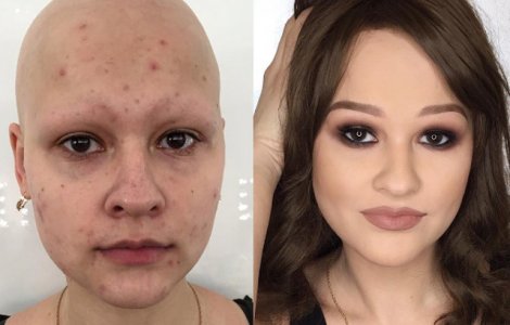  Top  Niciun defect nu e lasat la vedere: 10+1 cazuri in care machiajul a acoperit si cele mai urate cicatrice