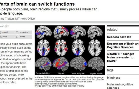 Parti ale creierului pot face schimb de functii