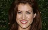 Actrita Kate Walsh din serialul ''Anatomia lui Grey'', operata pe creier