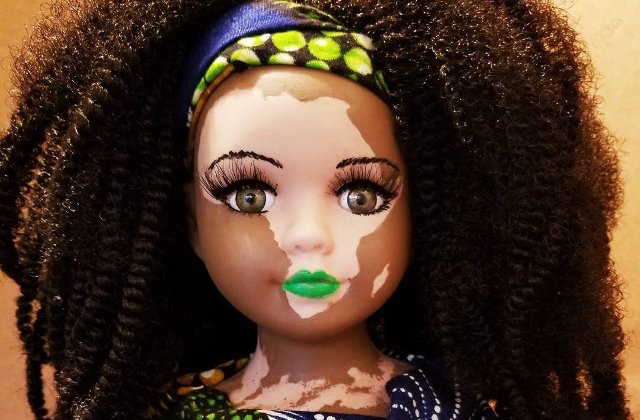 Au aparut papusile cu vitiligo pentru copiii care sufera de aceasta boala