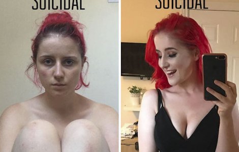  Top  Este "boala secolului". 10 imagini dure cu persoane care sufera de depresie