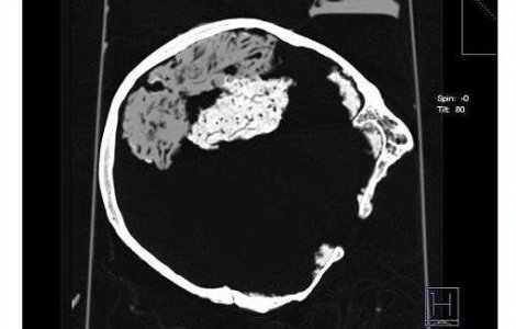 S-a descoperit un creier de 2.500 de ani