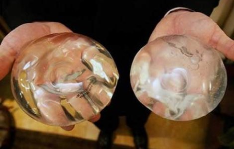  Top  TOP 7: Povesti incredibile despre implanturi cu silicon