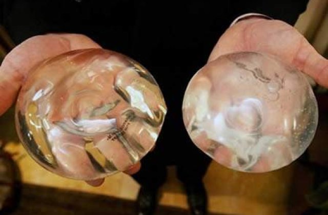 TOP 7: Povesti incredibile despre implanturi cu silicon