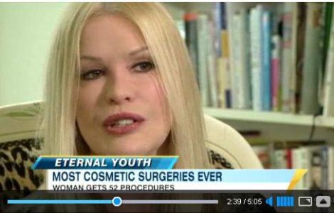  Video  Femeia cu 52 de operatii estetice