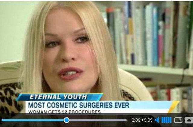 [VIDEO] Femeia cu 52 de operatii estetice