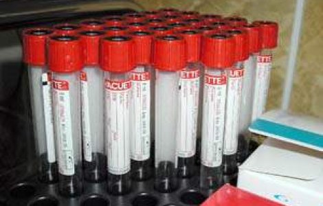 Primul bolnav de SIDA, videcat cu un transplant de maduva