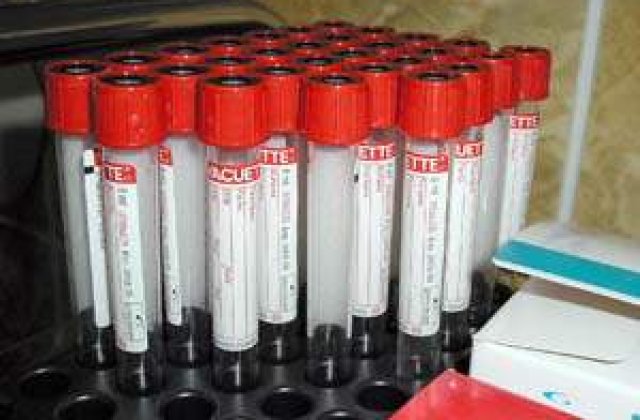 Primul bolnav de SIDA, videcat cu un transplant de maduva