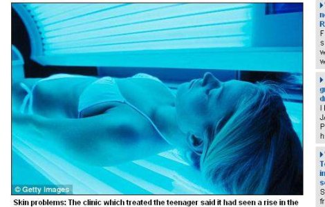 O adolescenta a facut cancer la piele de la bronzat artificial