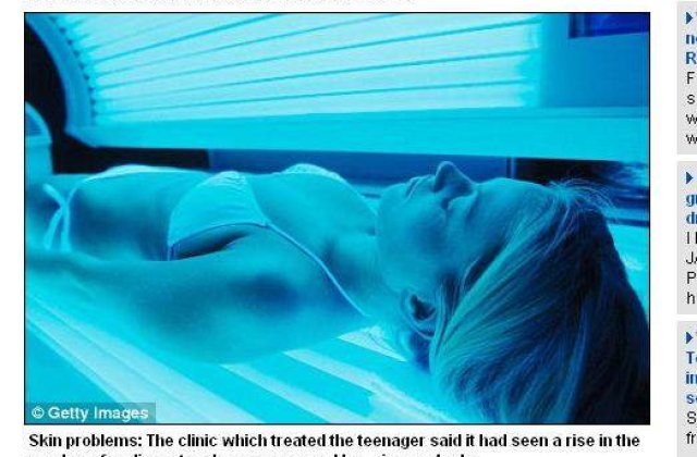 O adolescenta a facut cancer la piele de la bronzat artificial