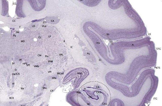 Primul indiciu in identitificarea Alzheimerului