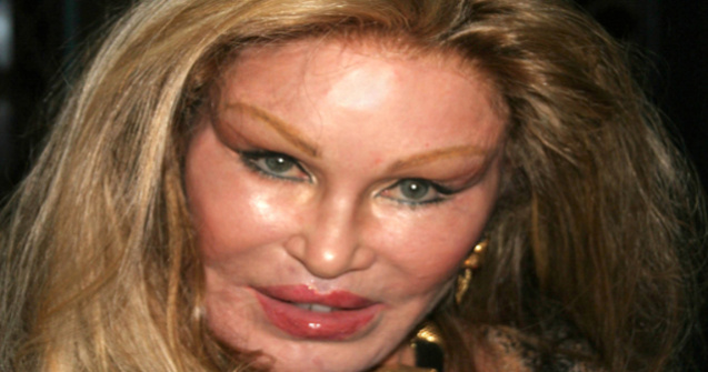  Top  Operatii estetice nereusite: 8 vedete care si-au distrus chipul