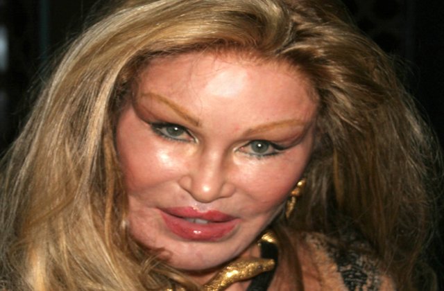 Operatii estetice nereusite: 8 vedete care si-au distrus chipul