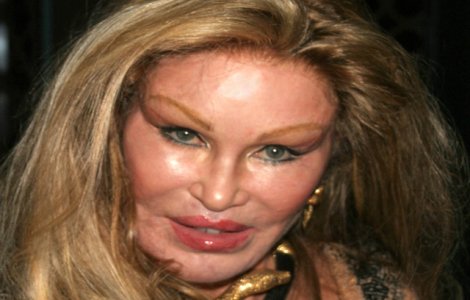  Top  Operatii estetice nereusite: 8 vedete care si-au distrus chipul