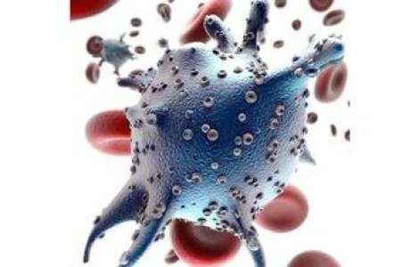  Top  Ce boli ne ameninta in secolul XXI