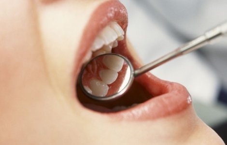 Peste un sfert din populatia Romaniei are edentatie totala (lipsa dintilor)