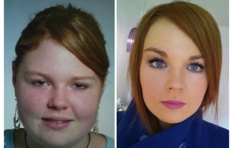  Top  10+ imagini care arata cat de mult se schimba chipul oamenilor dupa ce au slabit