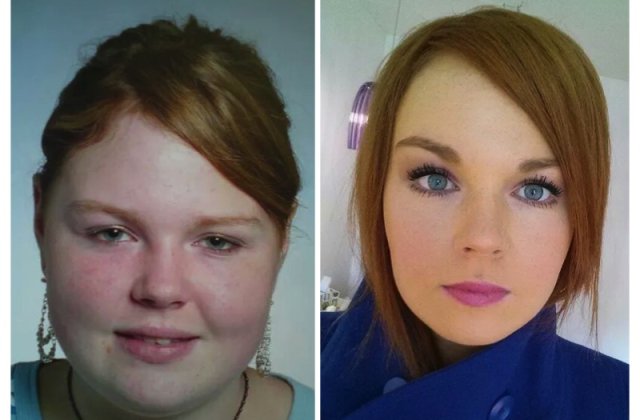 10+ imagini care arata cat de mult se schimba chipul oamenilor dupa ce au slabit