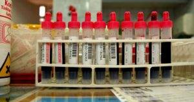 Personalitatea profesionala in functie de grupa sangvina