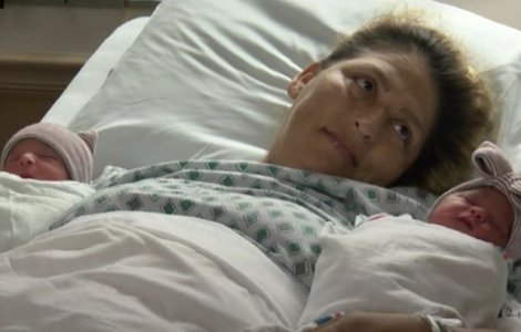 Doi gemeni au impresionat intreaga lume dupa ce s-au nascut in ani diferiti