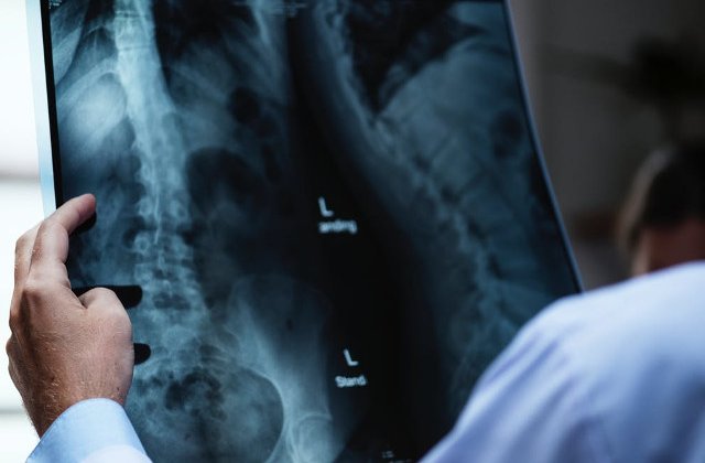 Chirurgul britanic care si-a gravat initialele pe ficatii pacientilor a scapat de inchisoare