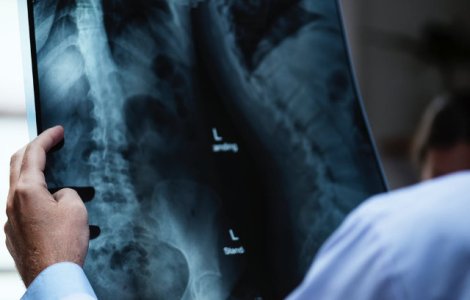 Chirurgul britanic care si-a gravat initialele pe ficatii pacientilor a scapat de inchisoare