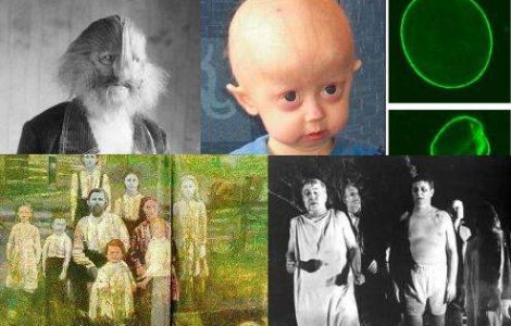  Top  Top 10: Cele mai ciudate boli din lume