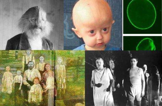 Top 10: Cele mai ciudate boli din lume