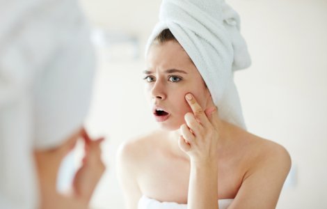  Top  Credeai ca ai scapat? 7 alimente care provoaca acnee la maturitate