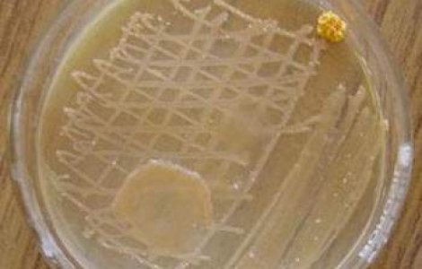 Cum trateaza germanii infectiile cu E.coli?