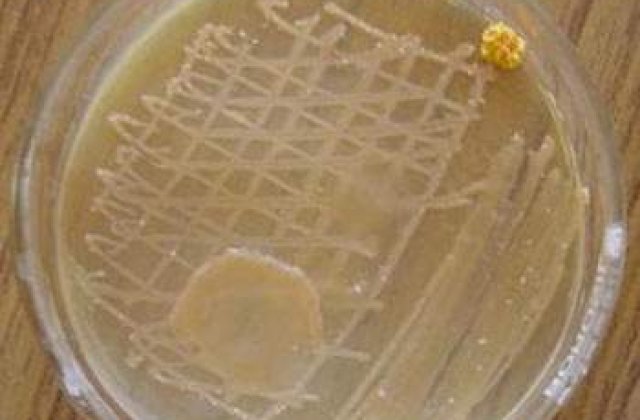 Cum trateaza germanii infectiile cu E.coli?