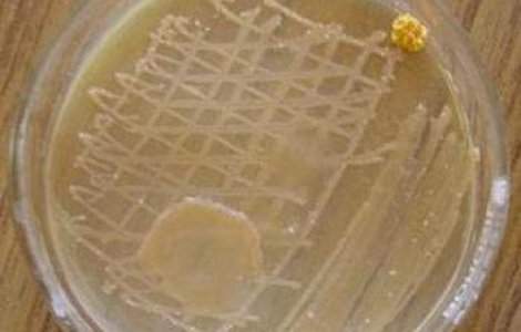 Cum trateaza germanii infectiile cu E.coli?