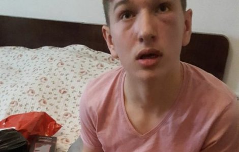 Un elev de clasa a VIII-a a fost batut de tatal unui coleg