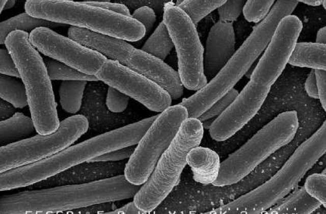 Mai provoaca bacteria E.coli victime?