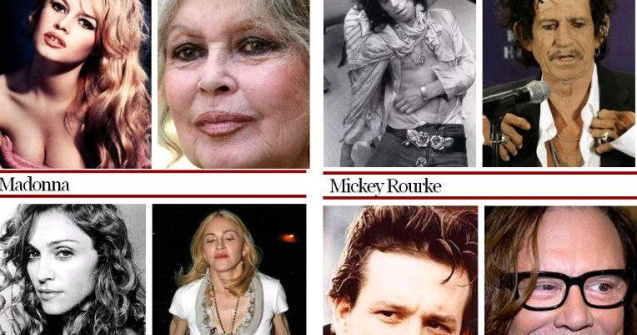  Top  10 celebritati care au imbatranit URAT