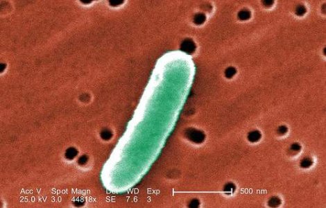 Patru cazuri de E.coli in SUA