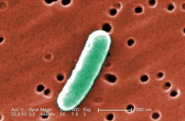 Patru cazuri de E.coli in SUA