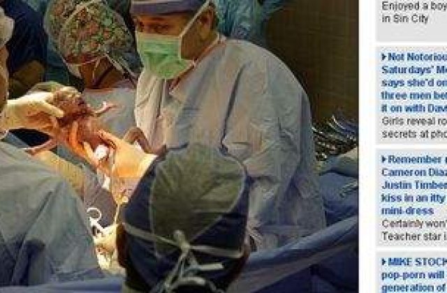 A nascut sextupleti in 3 minute