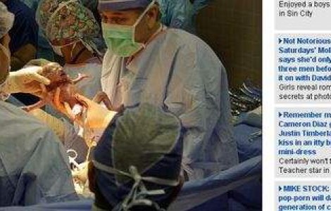 A nascut sextupleti in 3 minute