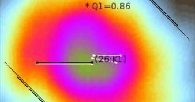 Inventie romaneasca: Aplicatie iPhone ce detecteaza cancerul de piele