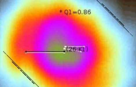 Inventie romaneasca: Aplicatie iPhone ce detecteaza cancerul de piele